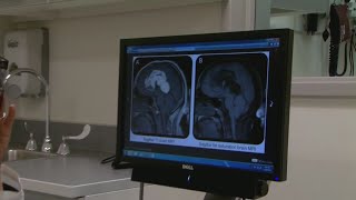 Pitt study finds when kids are treated immediately for concussions, their recovery is quicker