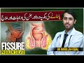 What Is Fissure Sharp Pain In Anus Treatment At Home Treatment Of Pain In Poti Wali Jagah Pe D