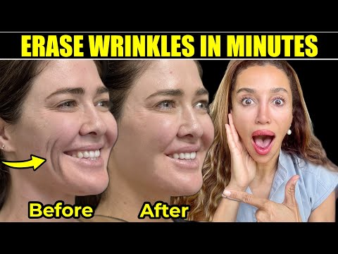 Incredibly Shocking Results I'm Seeing from PDGF in my Patients!