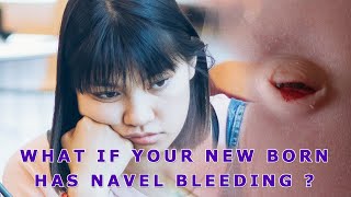 What If Your New Born Baby Has A Navel Bleeding ? | Neosporin Review | WiniPrincy
