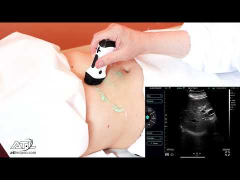 Ecografia addome superiore con Ecografo palmare Wireless CERBERO4.0 B-MatrixSound