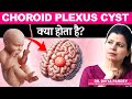 Causes And Treatment Of Choroid Plexus Cysts In Babies Choroid Plexus Cyst Explained