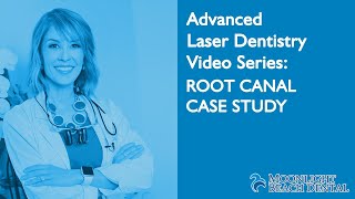 Laser Dentistry Series: Laser Root Canal