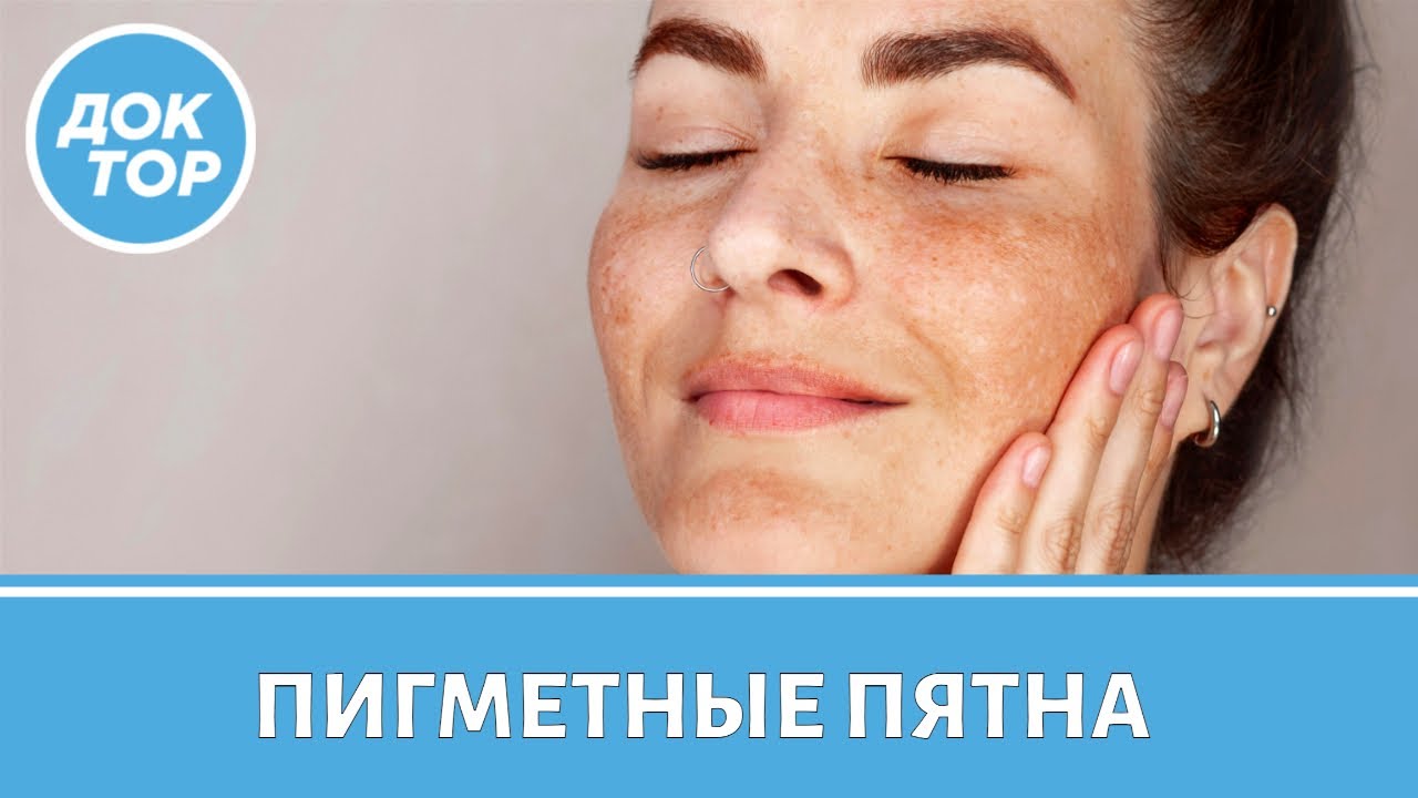 Врач–косметолог ответила, можно ли навсегда избавиться от пигментных пятен