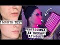 TESTING MEDICAL GRADE LED THERAPY AT HOME Demark Q Big Bright Acne Buster 1 Month Test GIVEAWAY
