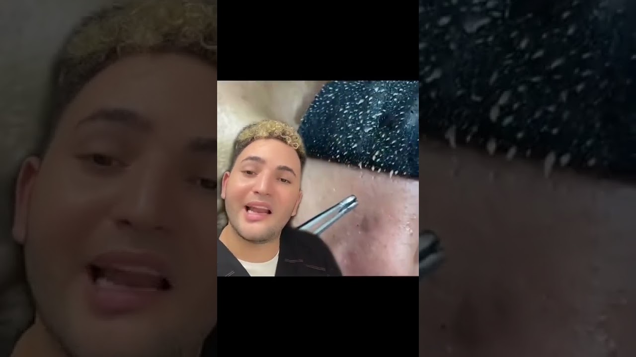 Watch Bandas adhesivas para puntos negros y filamentos sebáceos ⁉️⁉️⁉️ #skincare #skincaretips #beauty Now Bandas adhesivas para puntos negros y filamentos sebáceos ⁉️⁉️⁉️ #skincare #skincaretips #beauty