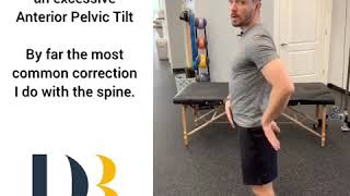 Low Back Pain ? May need to correct that anterior pelvic tilt!