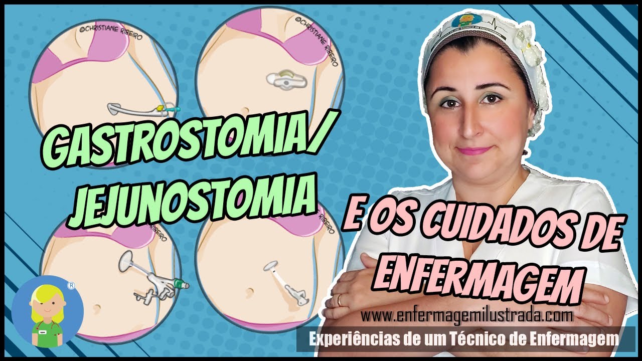 Gastrostomia / Jejunostomia e os Cuidados de Enfermagem
