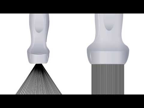 Basic Ultrasound Physics for EM