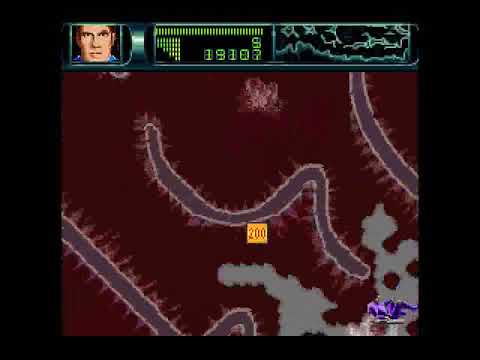 Rex Ronan: Experimental Surgeon (SNES) - Stage 5: Right Lung