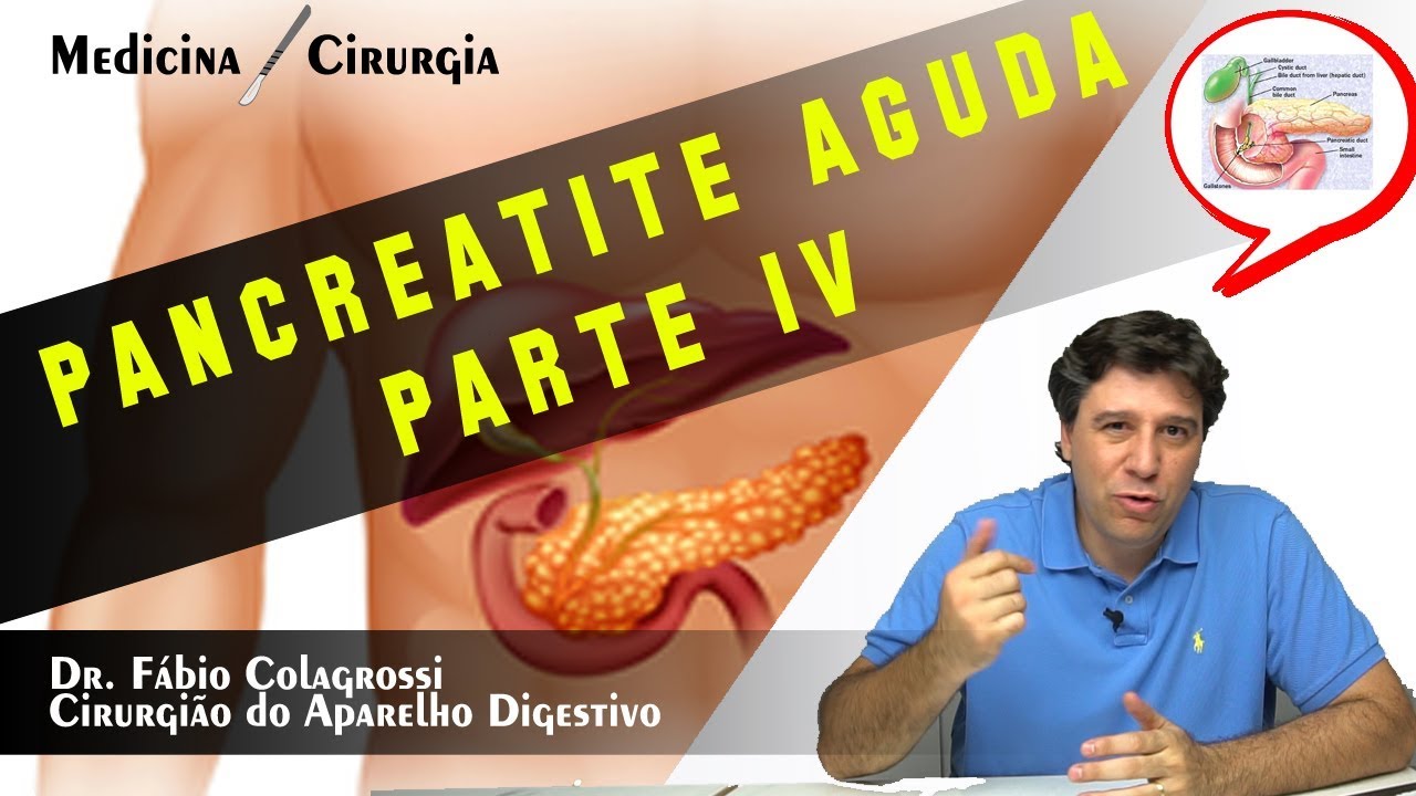 PANCREATITE AGUDA - TRATAMENTO AULA 4
