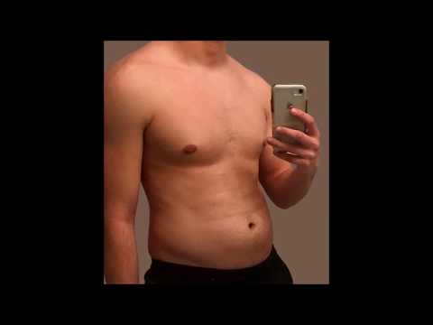 Morphs 1911 1916