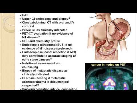 Gastric Cancer Etiology Refine Search