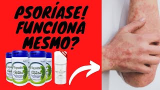 Como Acabar Com A Psoríase? Óleo de Copaíba é Bom?