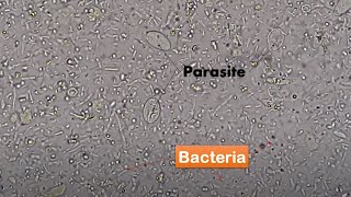 Bacteria and Parasites in stool Microscopy/ Live motile bacteria and cysts of Giardia lamblia