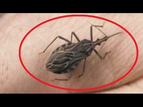 Anticorpo lyambliya analisi del sangue totale Parassiti polmonari della persona