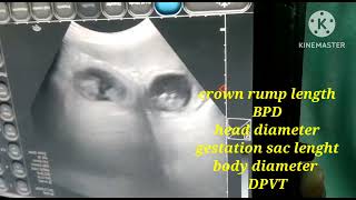 canine fetal age calculation by using ultrasound (pregency fetal age calculation in dogs)
