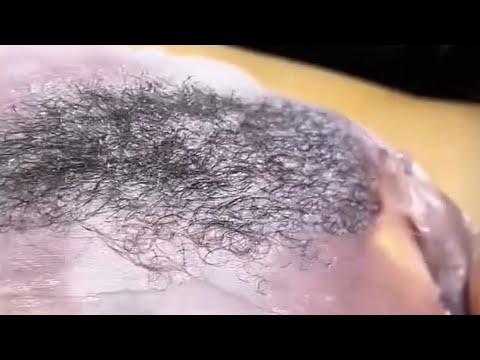 Brazilian sugaring sugarwaxing for beginners(11)#viral#brazilian#waxing#wax#sugaring#sugarwax