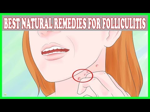 Folliculitis Treatment - 9 Effective Natural Remedies For Folliculitis | Best Home Remedies