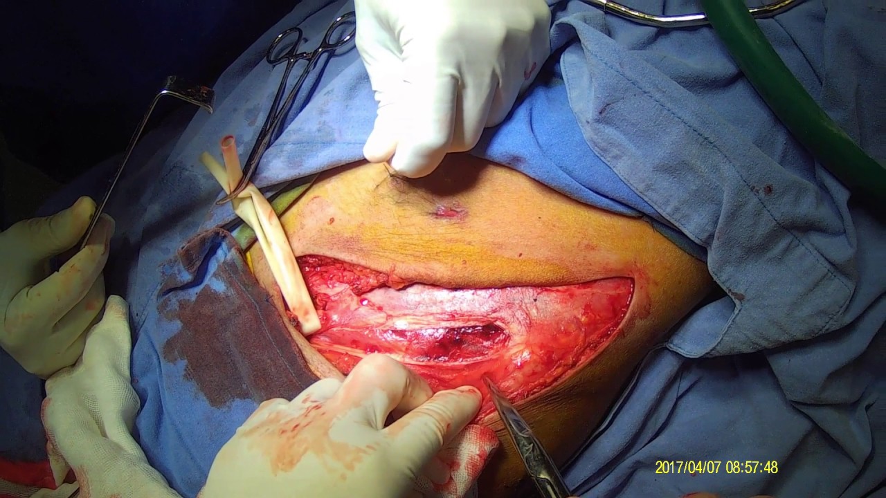 Alejandro Martínez Ramírez-35