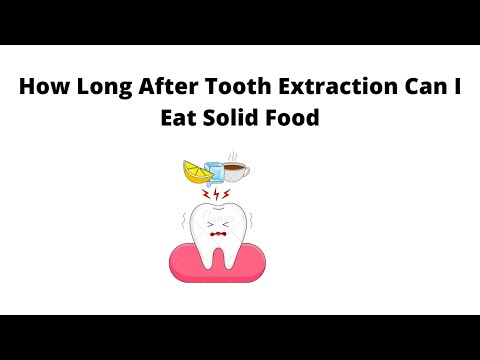 How Long After Tooth Extraction Can I Eat Solid Food | Quick Guide | 2021-22