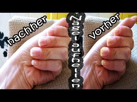 Das ergebnisreiche Mittel der Behandlung nogtewogo gribka Als es unterscheidet sich die Creme von der Salbe eksoderil