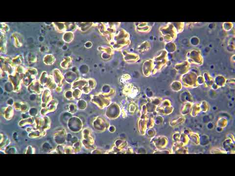 Кровь под микроскопом MAGUS Bio 260