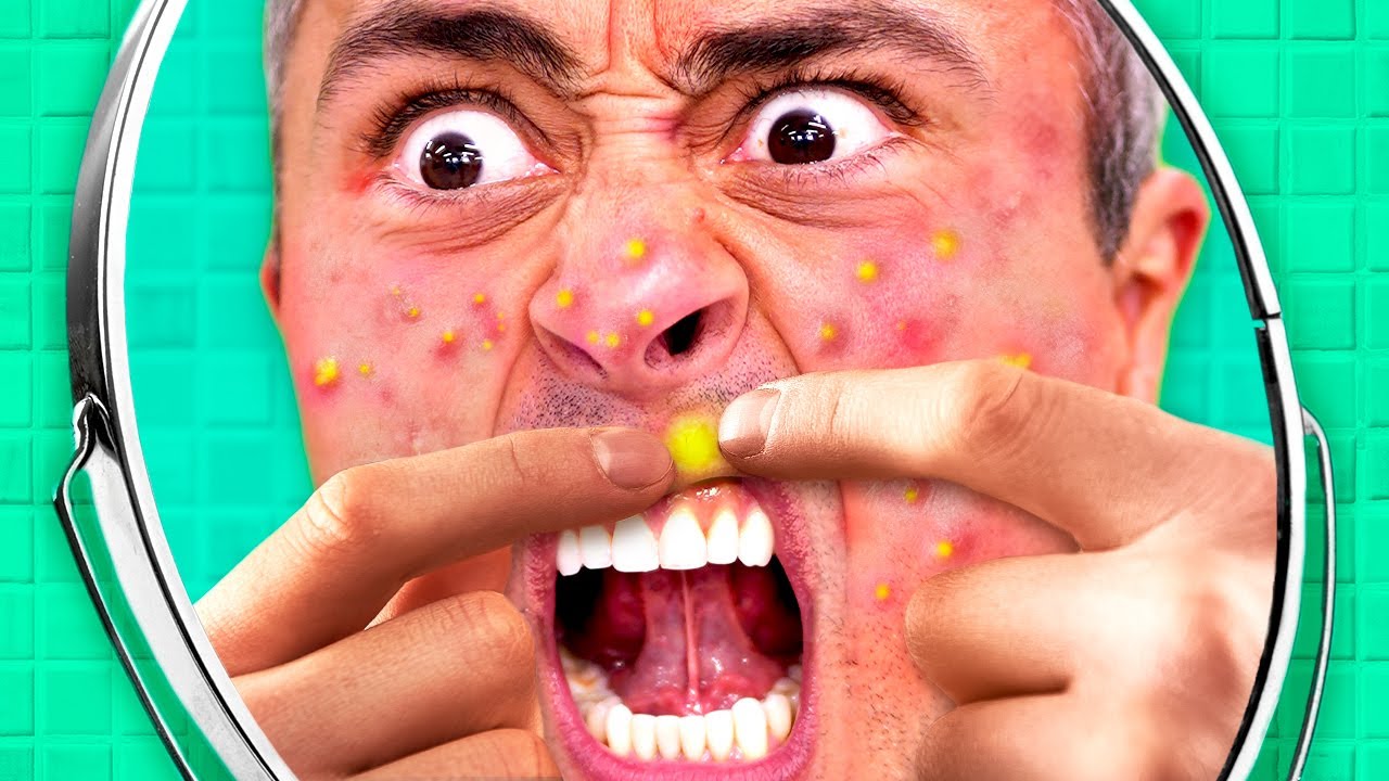 Por que você NÃO DEVE espremer suas ESPINHAS?