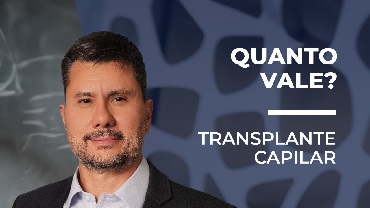 Quanto custa um transplante capilar: fatores que influenciam o preço