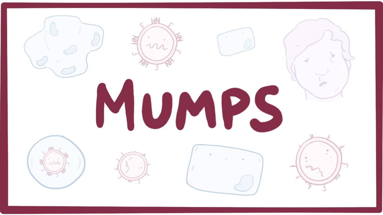 Mumps - symptoms, diagnosis, treatment, pathology