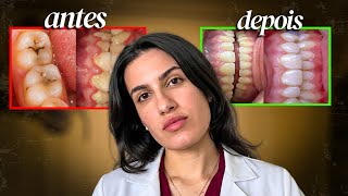 Um SIMPLES HÁBITO que melhora 106% a saúde da sua boca