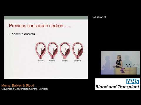 Management of Obstetric Haemorrhage