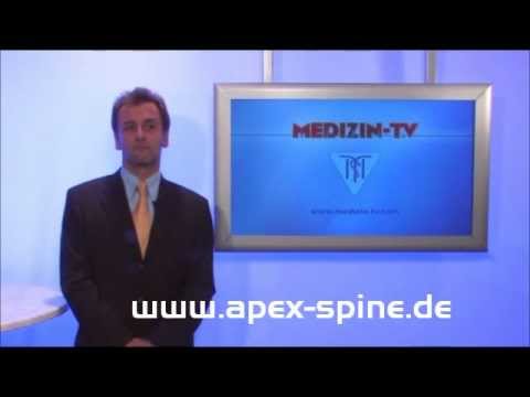Wenn schlecht schmerzende Gelenke an den Fingern Rückenschmerzen medizinische Beratung
