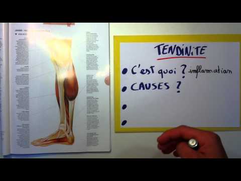 comment guerir une tendinite de la patte d'oie