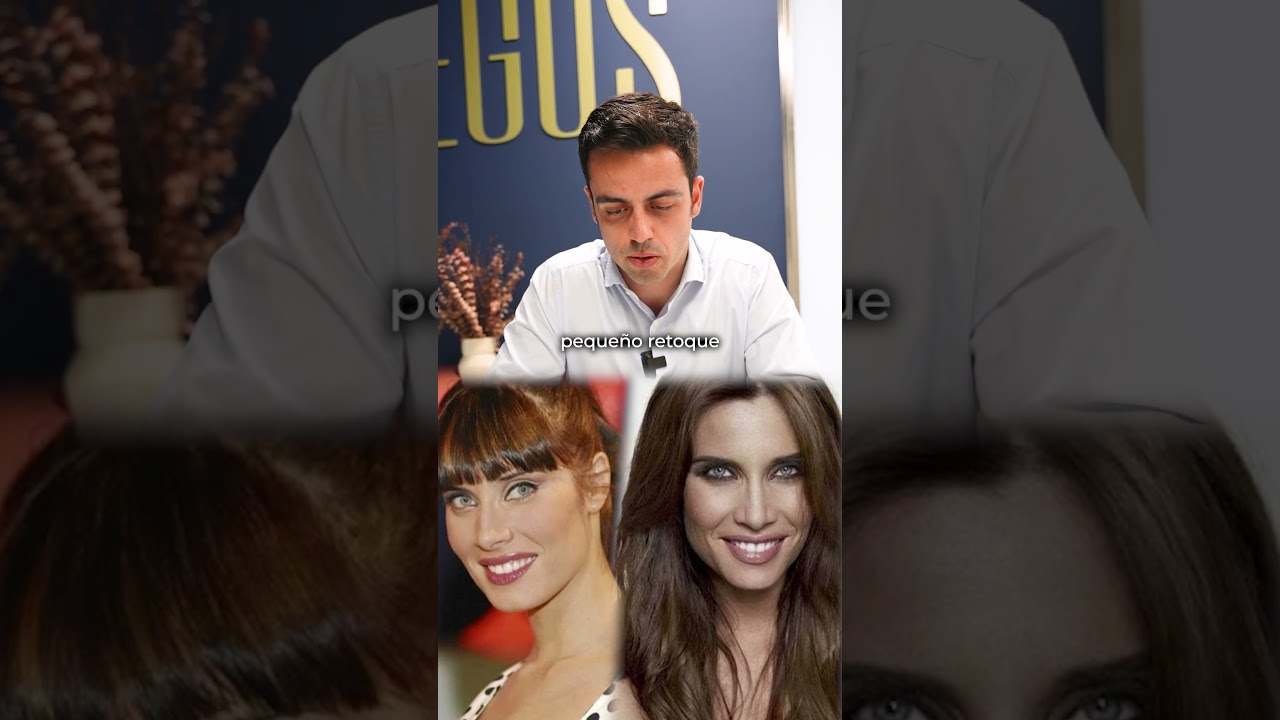 😲 ¿Ha cambiado Pilar Rubio? El Dr. Martín analiza los posibles retoques