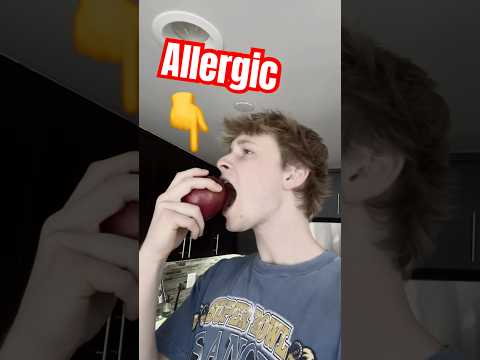 Eating food I’m ALLERGIC to… PART 2
