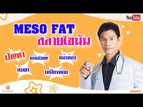 เมโสแฟต ยี่ห้อไหนดี