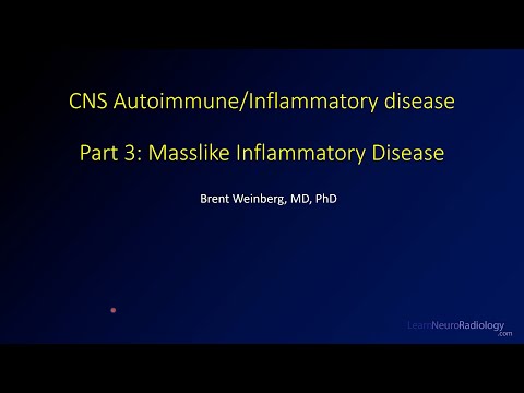 Imaging CNS autoimmune and inflammatory disease – Part 3 - Masslike inflammatory disease