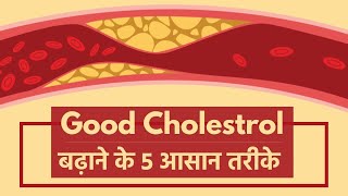 Good Cholesterol Increase Tips In Hindi। कैसे बढ़ाएं गुड कोलेस्ट्रॉल। onlymyhealth