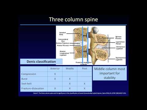 Spinal Trauma - Thoracolumbar Injury by Mini N. Pathria, M.D.