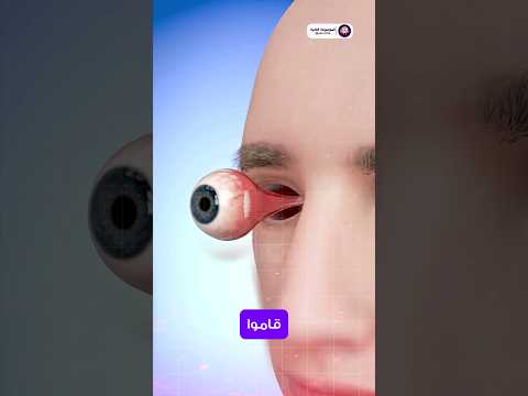 Eye transplant surgery 😳