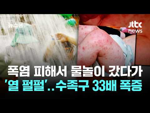 수족구병이 평소보다 33배 늘었어요! 여름 물놀이 후 손 씻기 꼭 해요