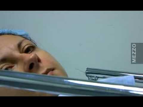 download lagu mp3 mp4 Natalie Dessay Surgery, download lagu Natalie Dessay Surgery gratis, unduh video klip Natalie Dessay Surgery