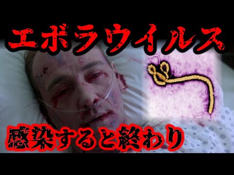 エボラウイルス(透過型電子顕微鏡)