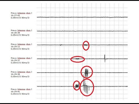 Próba tężyczkowa dr Katarzyna Toruńska