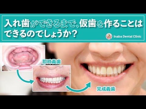 入れ歯ができるまで、仮歯を作ることはできますか？