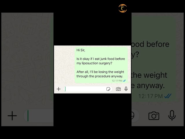 Most asked question regarding liposuction surgery