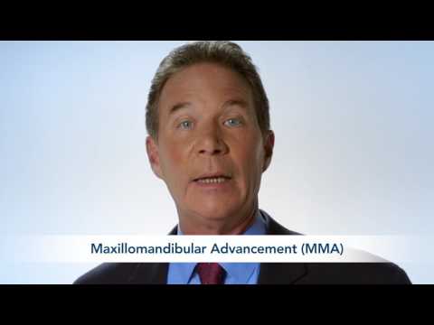 Obstructive Sleep Apnea Explained