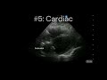 Top 10 Reasons To POCUS In Primary Care Butterfly Network