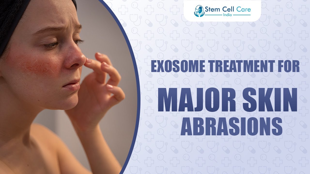 How Exosomes Repair Major Skin Abrasions | Fast Healing Without Scars